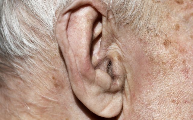 Что происходит с ушами по мере старения